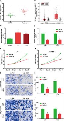 Long Non−Coding RNA H19 Regulates Glioma Cell Growth and Metastasis via miR-200a-Mediated CDK6 and ZEB1 Expression